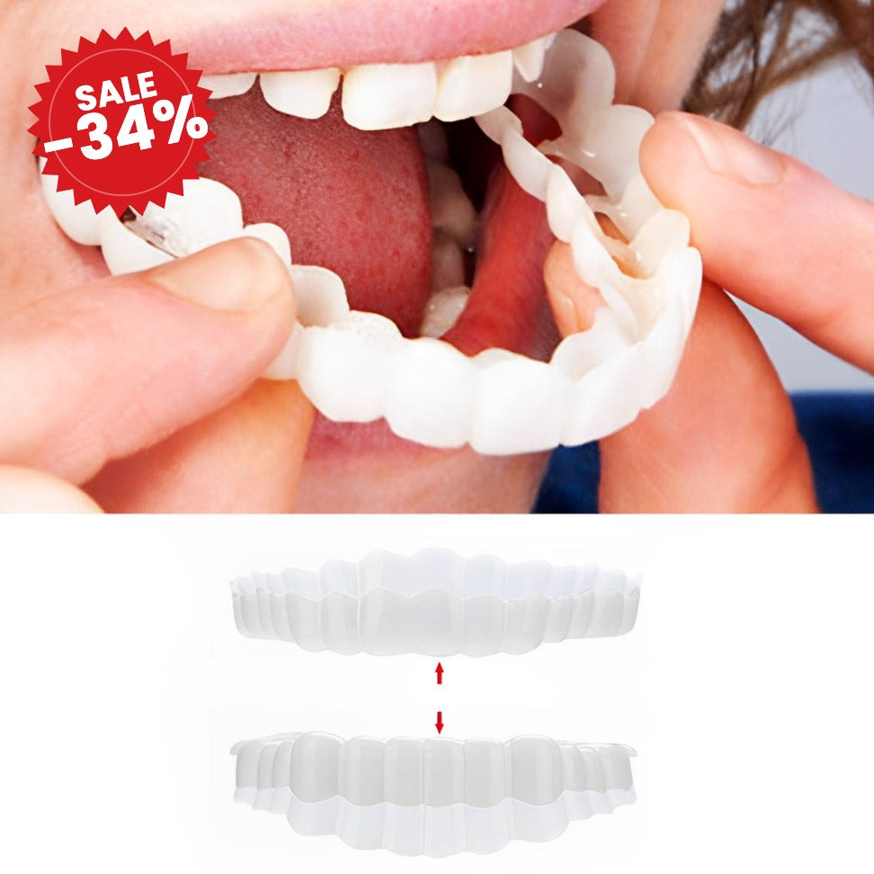 Custom Fit Veneers | Snap-On Smile Solution - SALE -34%